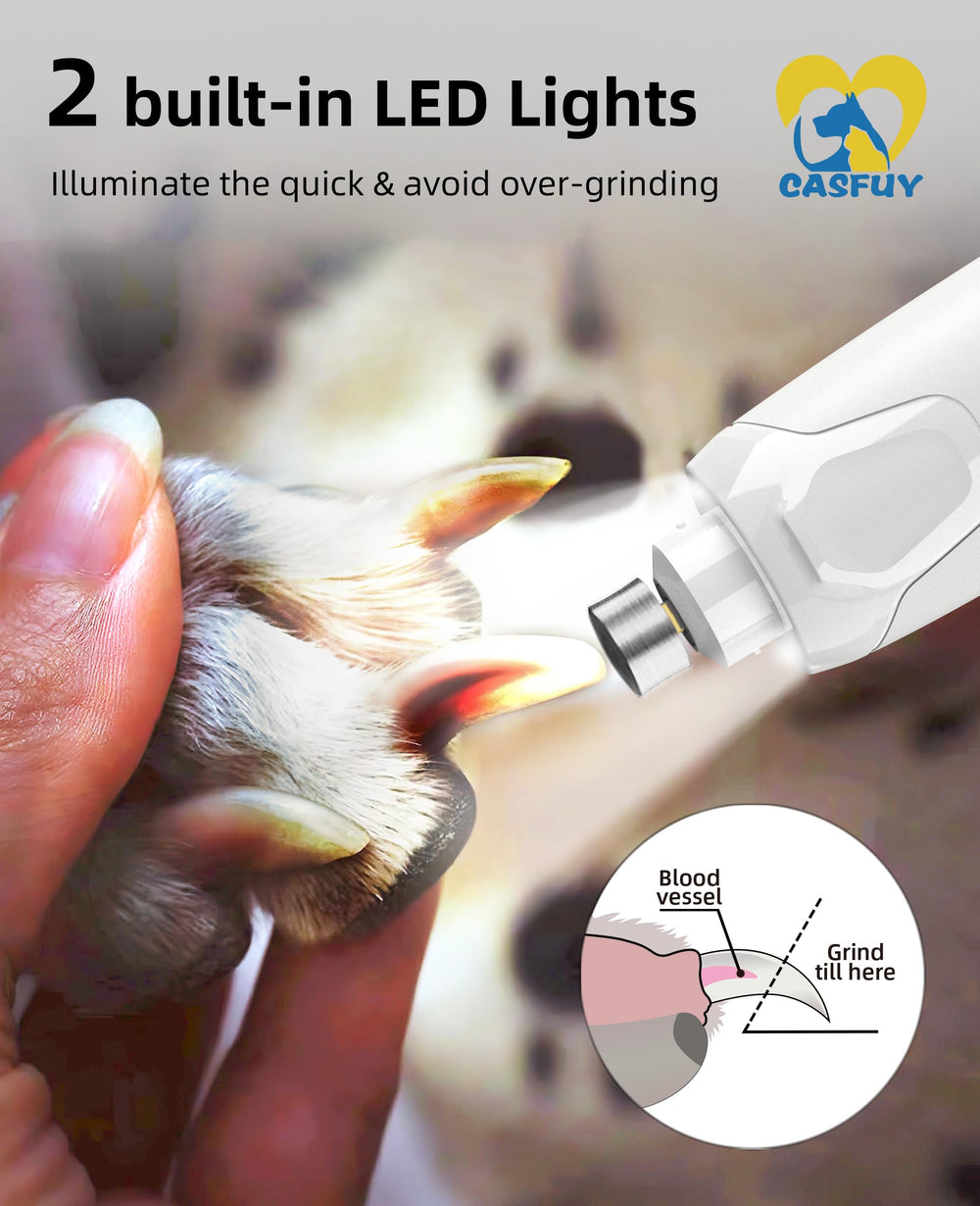 Casfuy nail grinder LED lights brighten nails for safer trimming.