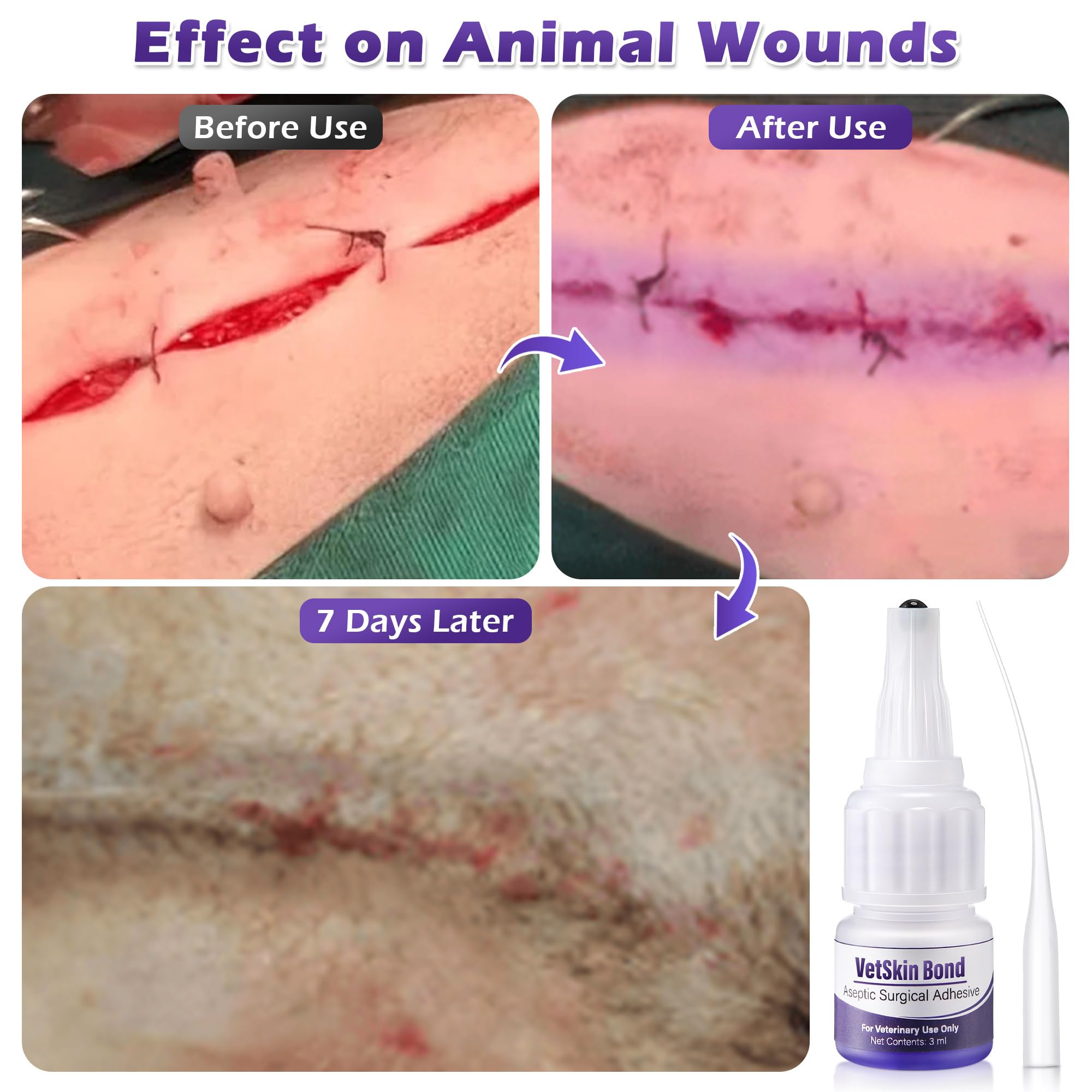 Ceoighe blue dye visibility helps ensure complete coverage during treatment.