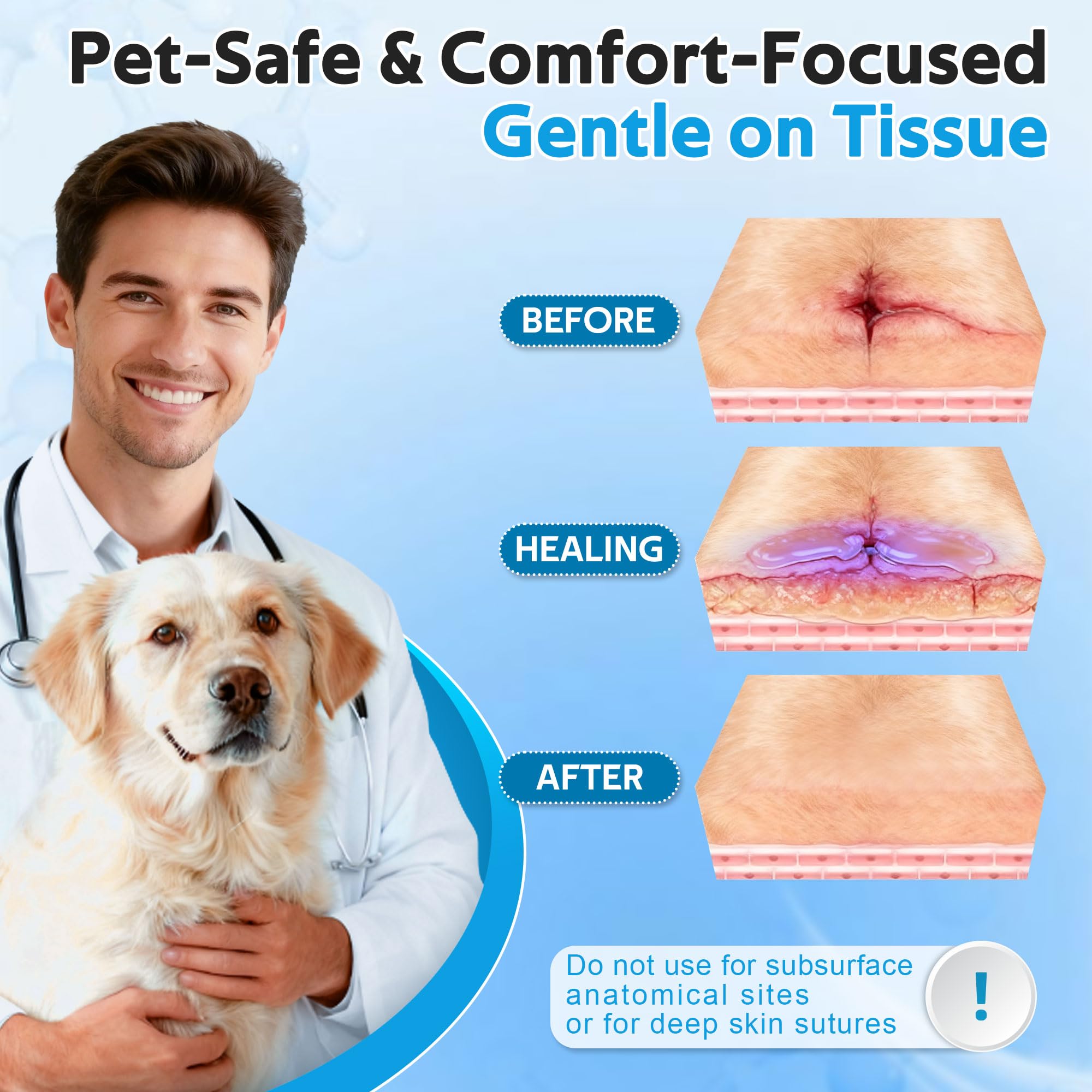 Blue dye highlights Mysora coverage for precise wound treatment.