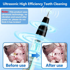 Ni-SHEN dental cleaning kit 4-parts black highlights comprehensive tools for tartar removal and care.