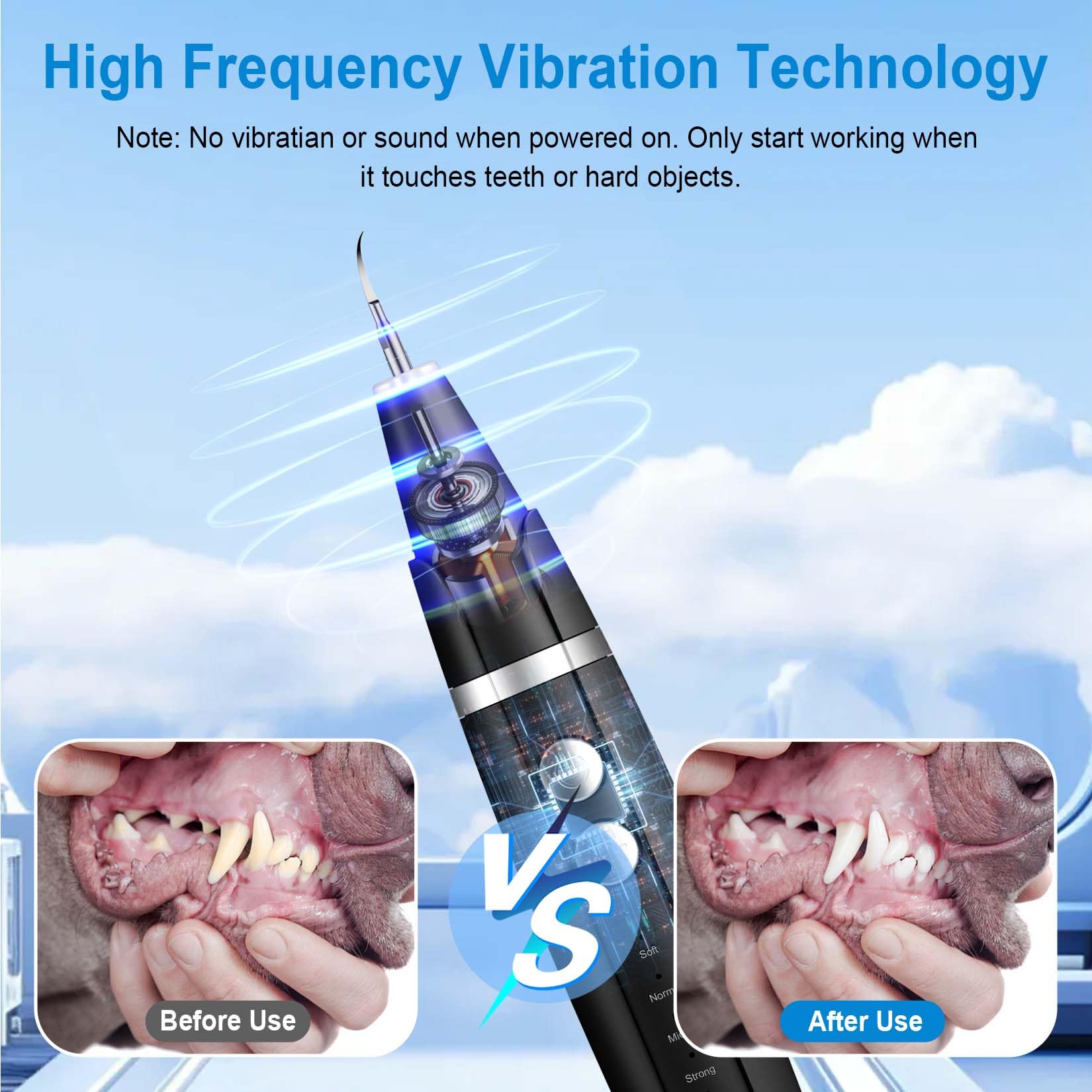 Ni-SHEN ultrasonic cleaner with LED lights illuminates the mouth for precise cleaning