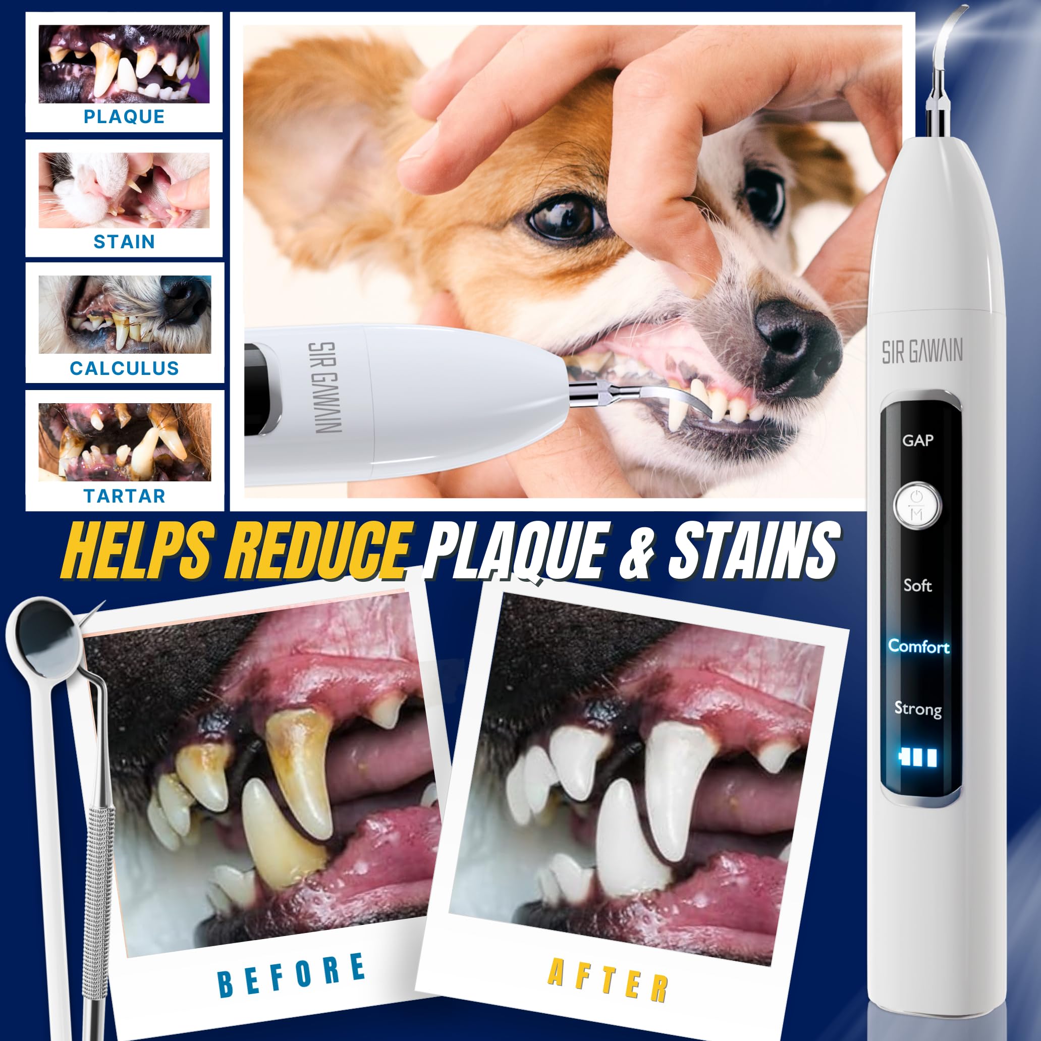 SIRGAWAIN three modes display enabling customizable dental care