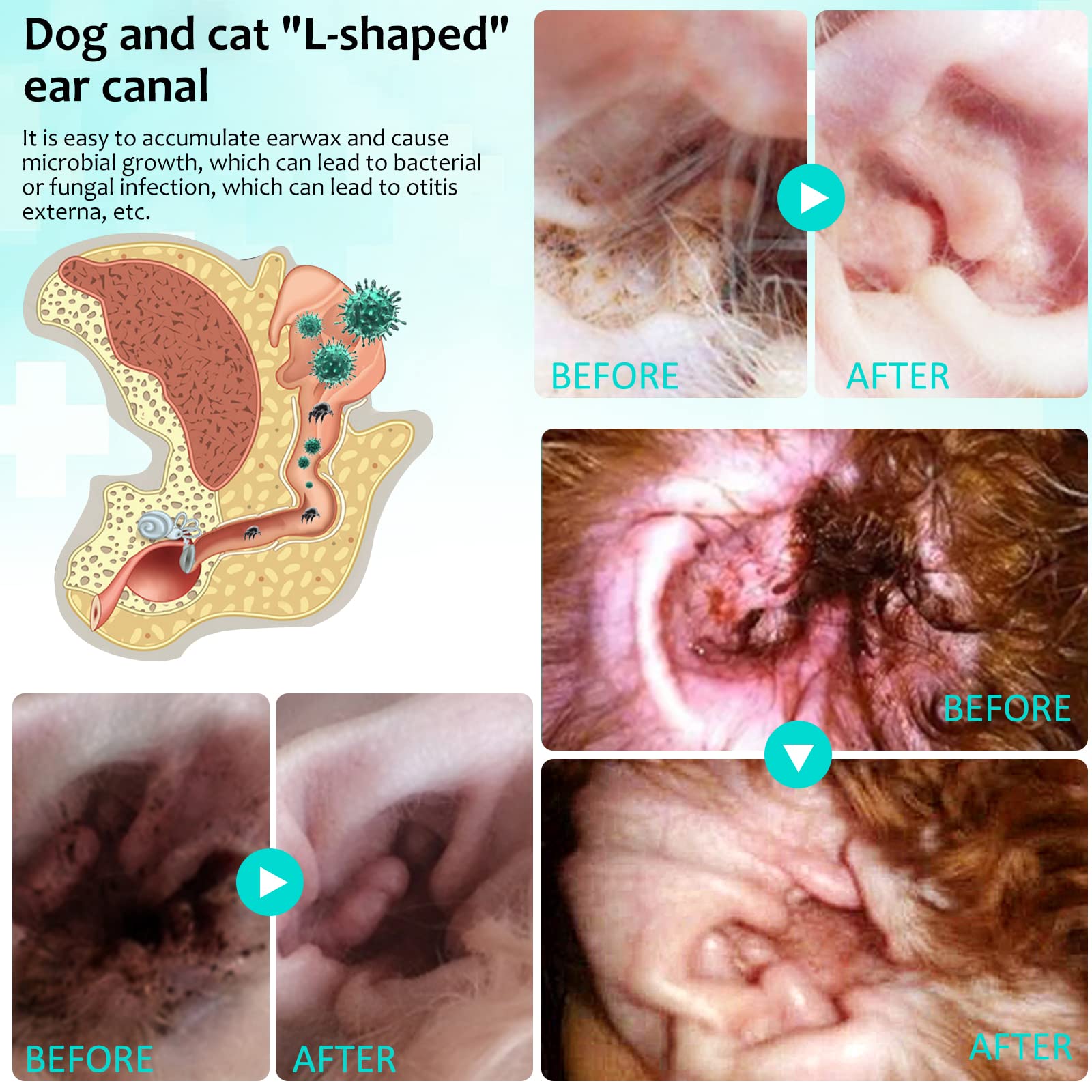 VOSIFSDIY ear-cleaner-anti-itch conveys relief from itching without harsh additives